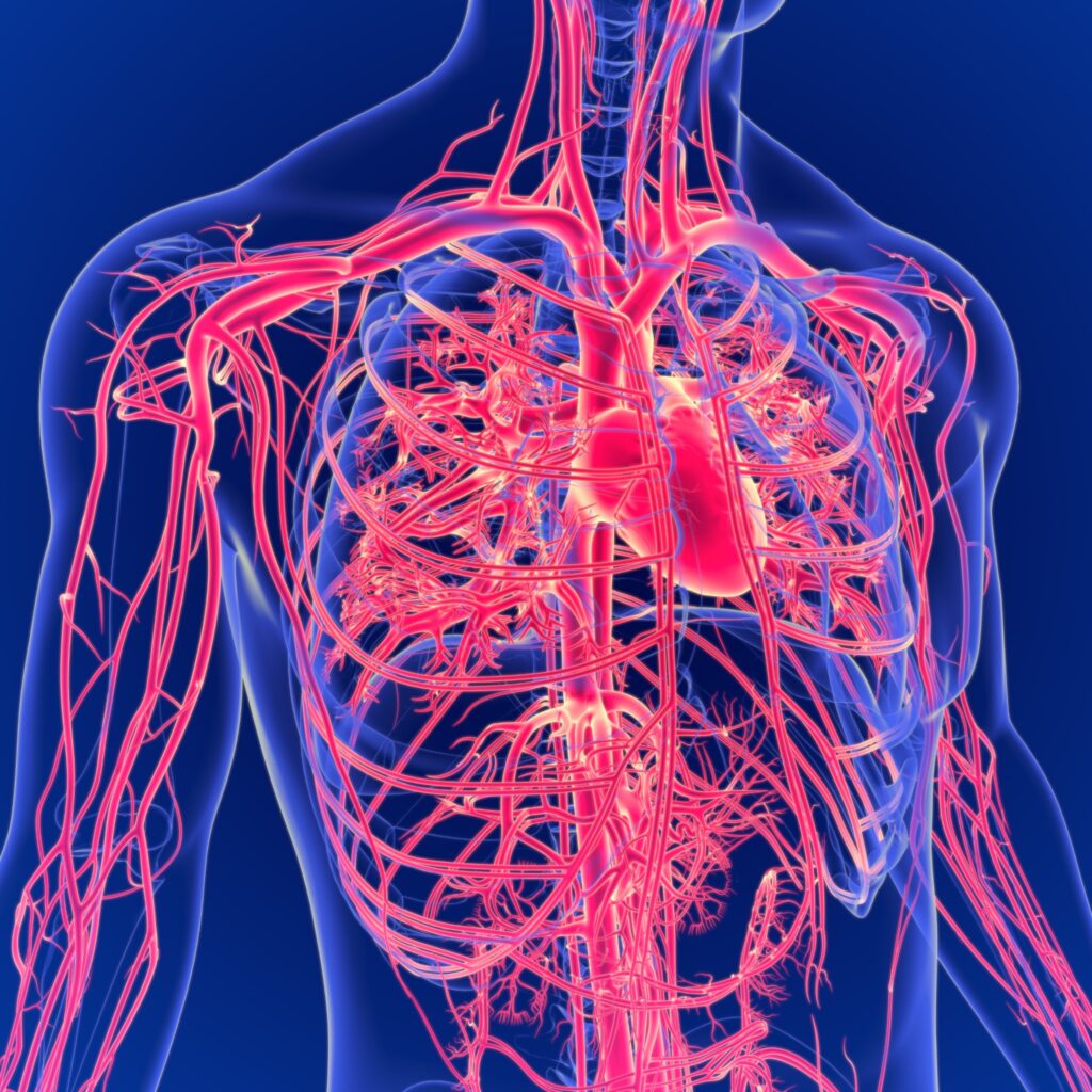 Bard PowerPort port catheter lawsuit