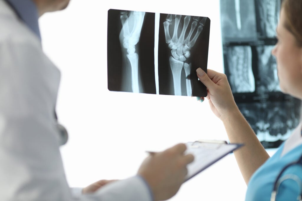 Topeka Bone Fractures Lawyer 